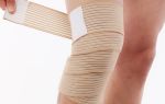 Эффективность тейпирования колена при артрозе: виды клейких лент и принципы их воздействия на заболевание, алгоритм наложения тейпов и противопоказания к процедуре