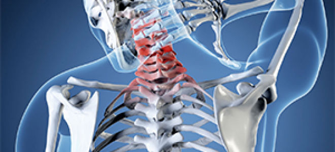 Рентген шейного отдела позвоночника: особенности диагностического метода, особенности подготовки к исследованию, что показывает снимок и кому противопоказана процедура