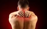 Больно поворачивать шею: как и почему возникает шейный прострел, способы терапии и методы облегчения состояния, основные симптомы патологии