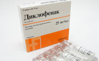 Выбираем таблетки от хондроза: список препаратов иностранных и отечественных производителей, эффективные недорогие лекарства, показания и противопоказания к использованию