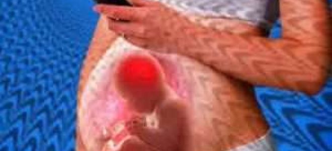 Конкресценция позвонков (сращивание): основные причины, симптомы, диагностика заболевания, лечение и профилактические меры, возможные осложнения