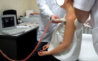 Растяжение связок плечевого сустава: причины, симптомы и лечение — сайт об опорно двигательной системе человека