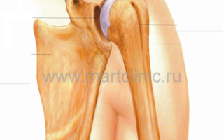 Артроз плечевого сустава — полное описание заболевания, симптомы и эффективные методы лечения