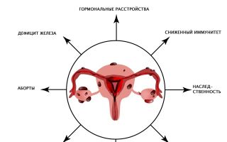 Месячные при эндометриозе: как проходят, может ли быть задержка