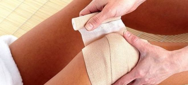 Боль под коленом: почему возникает, какие заболевания провоцируют симптом, методы диагностики, как лечить болевой синдром лекарственными препаратами и средствами народной медицины