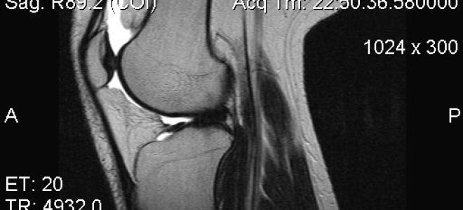 Мрт коленного сустава: показания и противопоказания к проведению диагностики, подготовка и процесс проведения процедуры, информативность и стоимость методики