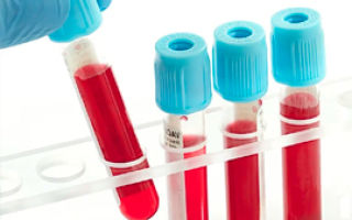 Как сдавать анализ на гормоны у женщин: как сдаются анализы, когда нужно, как правильно сдается кровь, как берут
