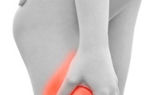 Миозит ног (воспаление): причины, характерные симптомы, лечение народными и медицинскими средствами