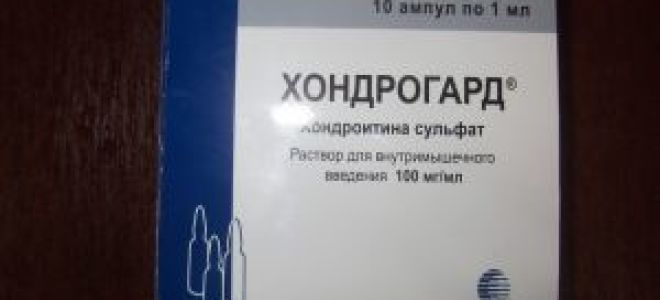 Аналоги хондролона: обзор дешевых российских и зарубежных препаратов, их состав и принцип действия, сравнительные характеристики и отзывы об эффективности