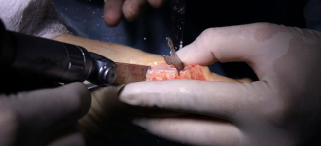 К какому врачу обратиться с косточкой на большом пальце ноги: проявление заболевания и риски осложнений, способы диагностики и лечения оперативным, медикаментозным и физиотерапевтическим методом