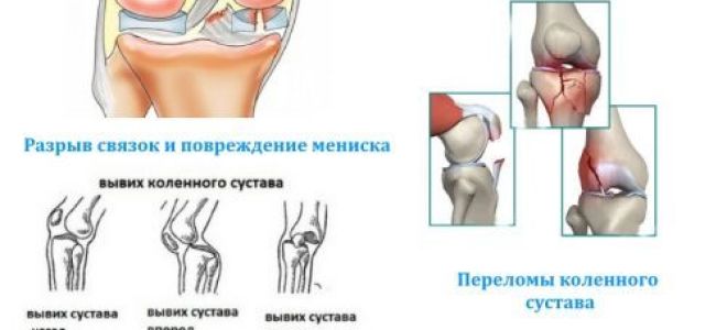 Болит колено когда сидишь: возможные заболевания и рекомендованные методы терапии, профилактические меры и когда идти к врачу
