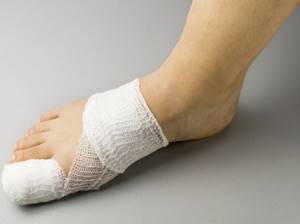 Вывих пальца на ноге: как вправить, первая помощь, чего нельзя делать, реабилитация и лечение мазями и кремами