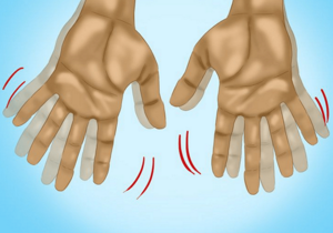 Упражнения для рук при туннельном синдроме запястья: правила выполнения и примеры комплексов, противопоказания и польза тренировок