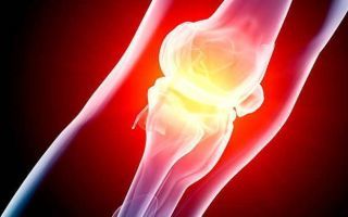 Скованность суставов: что это такое, симптомы, причины и методы лечения народными и медицинскими средствами