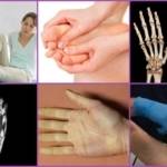 Немеют кончики пальцев рук и ног: физиологические и патологические причины состояния, способы диагностики и профилактика, современные и народные методы лечения