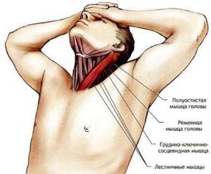 Растяжение мышц шеи: причины, симптомы, первая помощь при травме, народная и официальная медицина