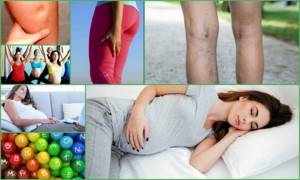 Немеют ноги при беременности: причины, что можно сделать в домашних условиях народными и медицинскими средствами, профилактика