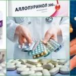 Лечение подагры препаратами, выводящими мочевую кислоту: основные принципы терапии, обзор медикаментозных средств, показания и противопоказания