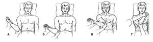 Вывих плеча: причины повреждения, как вправить, алгоритм действия, первая помощь и лечение, возможные осложнения и профилактика