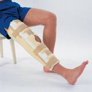 Нестабильность коленного сустава: причины и классификация патологии, специфические симптомы, методы диагностики и лечения, профилактика и возможные осложнения