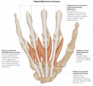 Разрыв сухожилия на пальце руки: классификация и клиническая картина, сроки выздоровления и как лечить, возможные осложнения