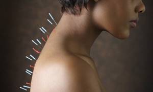 Массаж при болях в спине: разновидности методик, их полезные свойства, техника выполнения и особенности процедур, противопоказания к терапии