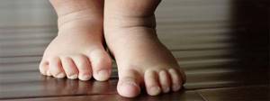 Шишка на ноге сбоку с внешней стороны стопы: что это может быть, возможные заболевания, основные причины и методы лечения, виды деформаций ног у детей и взрослых