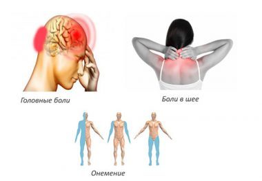 Остеохондроз позвоночника с корешковым синдромом: причины и симптомы возникновения патологии, диагностика и лечение заболевания, народные рецепты
