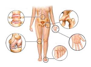 Лечебные свойства Аюрведы при заболеваниях суставов: основные принципы терапии заболеваний, показания и противопоказания к использованию, отзывы пациентов
