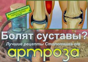 Народные средства при артрозе коленного сустава: рецепты нетрадиционной медицины, способы их применения и противопоказания к использованию