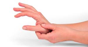 Болит сустав большого пальца на руке: синдром запястного канала и способы его лечения, когда требуется помощь врача и как предоствратить заболевание, возможные патологии