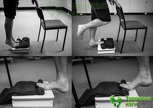 Лечебная гимнастика при пяточной шпоре: показания к ЛФК, комплекс полезных упражнений и правила их выполнения, эффективность занятий и отзывы пациентов