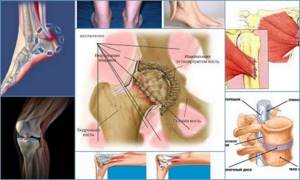 Энтезопатия суставов: формы и причины развития патологии, диагностические меры и способы терапии