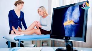 Артроз коленного сустава: признаки возникновения патологии, клиническая картина и способы диагностики, консервативная терапия в домашних условиях и показания для операции