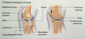Боль в колене сбоку с внешней стороны: особенности строения сустава и характер болевых ощущений, диагностика и особенности терапии