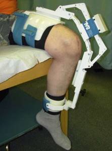 Контрактура коленного сустава: причины развития и классификация, симптомы при разных формах патологии, диагностика, методы лечения и реабилитации