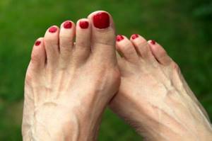 Шишки на ногах у большого пальца: что это и чем опасно, как лечить и как снять боль, 5 способов избавиться от недуга