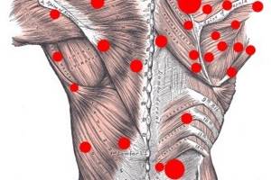 Почему болят мышцы спины: первая помощь, причины возникновения, упражнения и гимнастика для лечения недуга