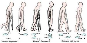 Костыли после эндопротезирования тазобедренного сустава: как правильно выбрать и ходить, общие правила и рекомендации, как избежать осложнений, когда отказываться от опоры