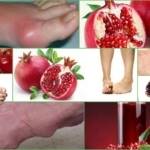 Употребление граната людьми, страдающими от подагры: можно ли есть фрукт при заболевании, в каких количествах, к чему приводит несоблюдение диеты