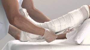 Растяжение связок коленного сустава: лечение в домашних условиях народными и медицинскими средствами, рекомендации врачей