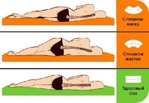 Как правильно спать при сколиозе: правила выбора ортопедического матраса и подушки, рекомендуемые позы для сна