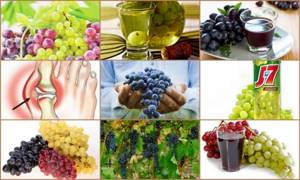 Вишня при подагре: химический состав и пищевая ценность, польза ягоды при болезнях суставов, рекомендации по употреблению и полезные рецепты