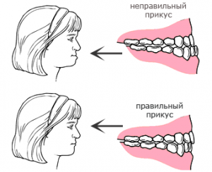 Воспаление челюстного сустава: причины и предрасположенность к заболеванию, специфические симптомы и методы диагностики, способы лечения и возможные осложнения