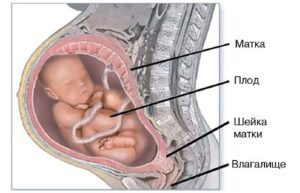Межпозвоночная грыжа и беременность: симптомы и причины заболевания, опасность для мамы и ребенка, способы терапии и особенности родоразрешения