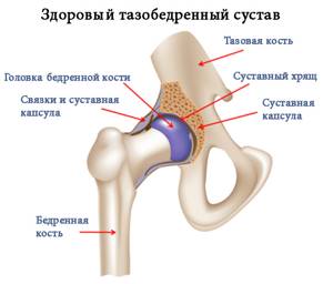 Хруст в тазобедренном суставе: возможные патологии, чем это опасно и что делать, способы диагностики и лечения