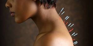 Растяжение мышц шеи: причины, симптомы, первая помощь при травме, народная и официальная медицина