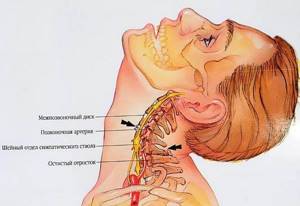 Ушиб шеи: симптомы, первая медицинская помощь пострадавшему, возможные осложнения, способы диагностики и лечения, последствия и реабилитация пациентов