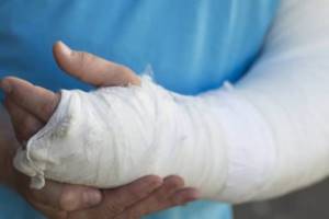 Перелом мизинца на руке: классификация и причины повреждения, специфические симптомы и правила оказания первой помощи, методы лечения и реабилитация, сроки восстановления