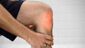 Лигаментоз коленного сустава: признаки и причины развития болезни, диагностические методики для определения патологии и способы терапии